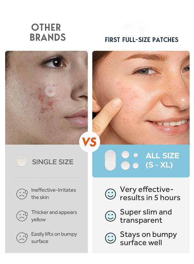 general Large Acne Pimple Patches, 5 Sizes 80 Patches for Large Breakouts, Acne Patches for Face, Chin or Body, Acne Spot Patch with Tea Tree & Calendula Oil, Hydrocolloid Bandages for Acne Skin - Image 3